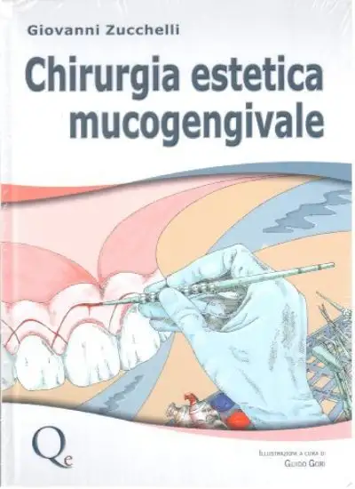 CHIRURGIA ESTETICA MUCOGENGIVALE